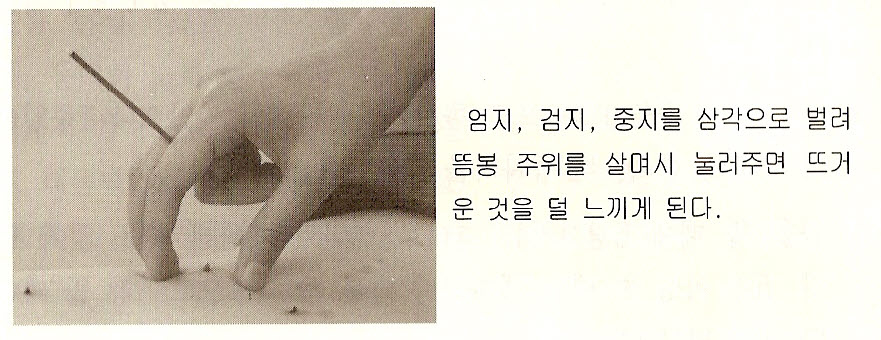 뜸 이미지