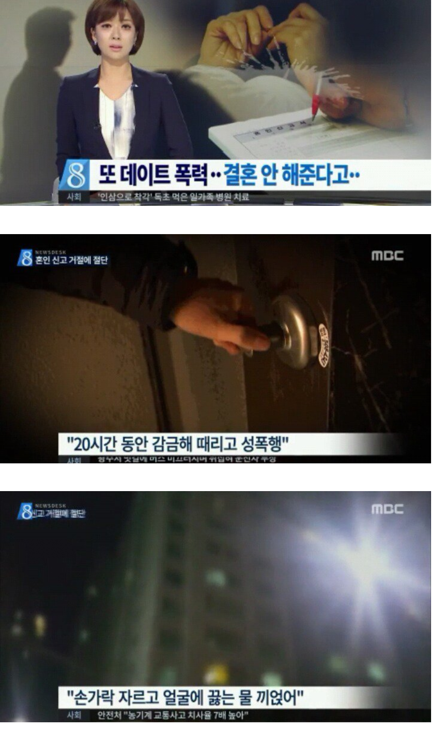 결혼거절에 손가락자르고 끓는물 얼굴에 부어버림(데이트폭력) | 인스티즈