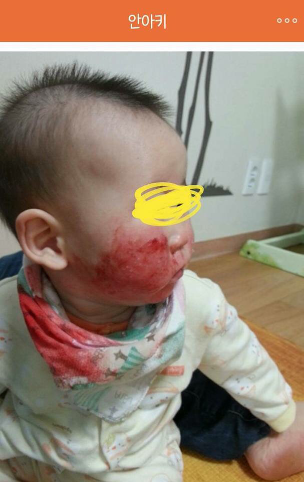 아기 약 안먹이고 자연 치유 시키는 안아키 라는 카페 (혐오주의) | 인스티즈