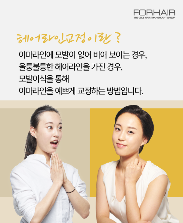 미미헤어라인 이미지