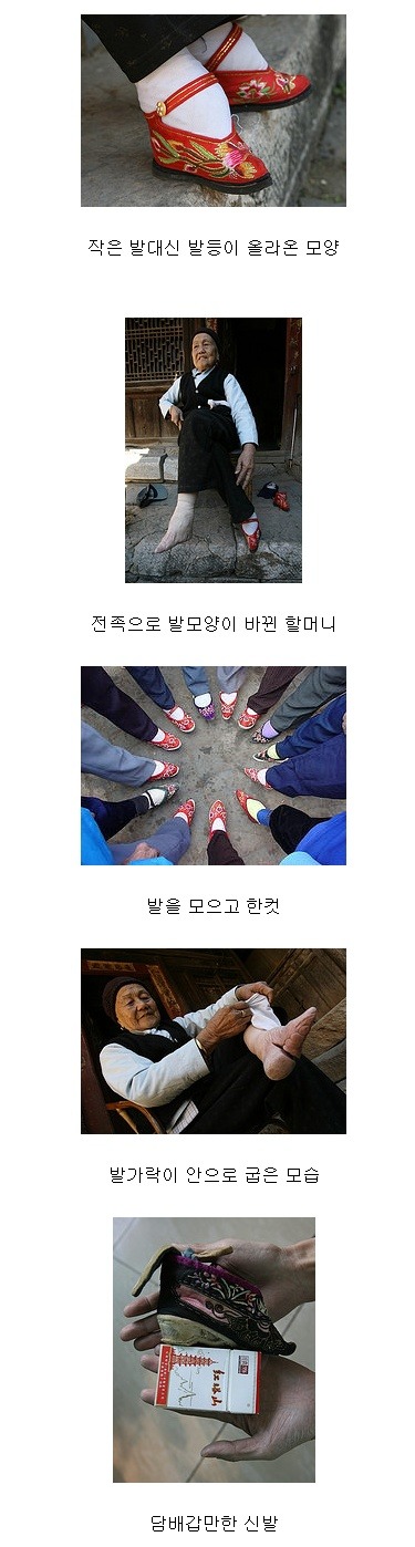 여자를 기형으로 만드는 세계 풍습들 | 인스티즈