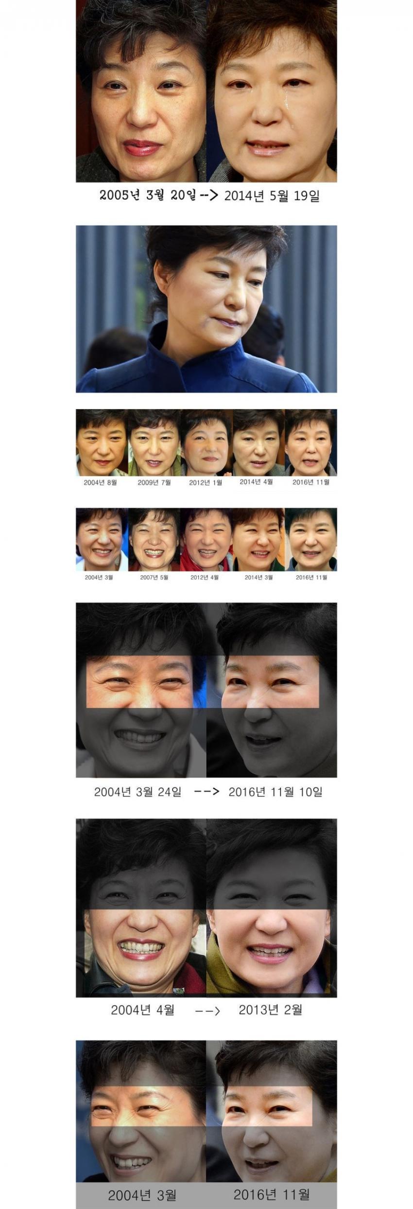 현대 의학의 위엄 | 인스티즈