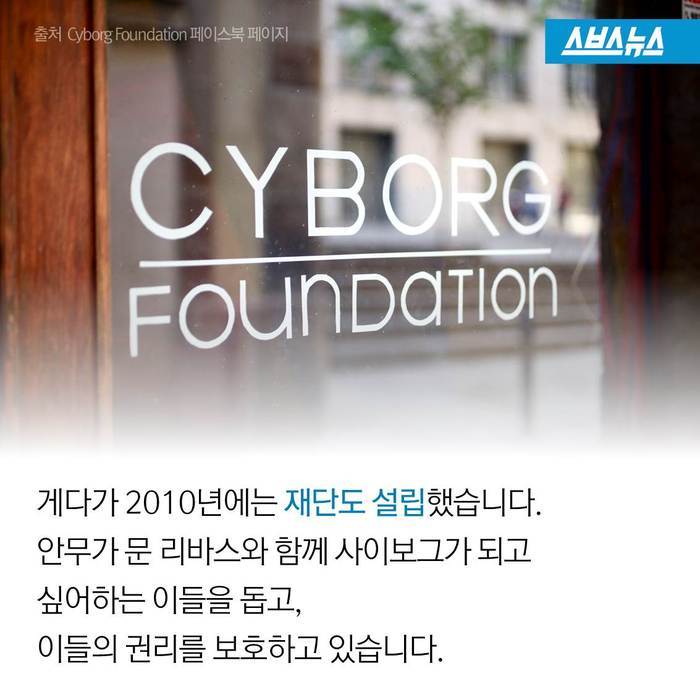  스스로 사이보그가 된 남자 | 인스티즈
