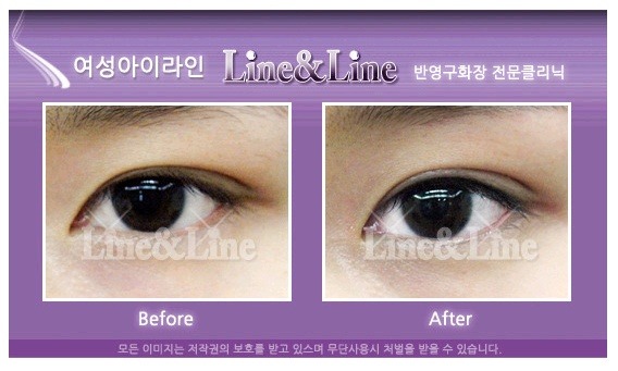 라인앤 이미지
