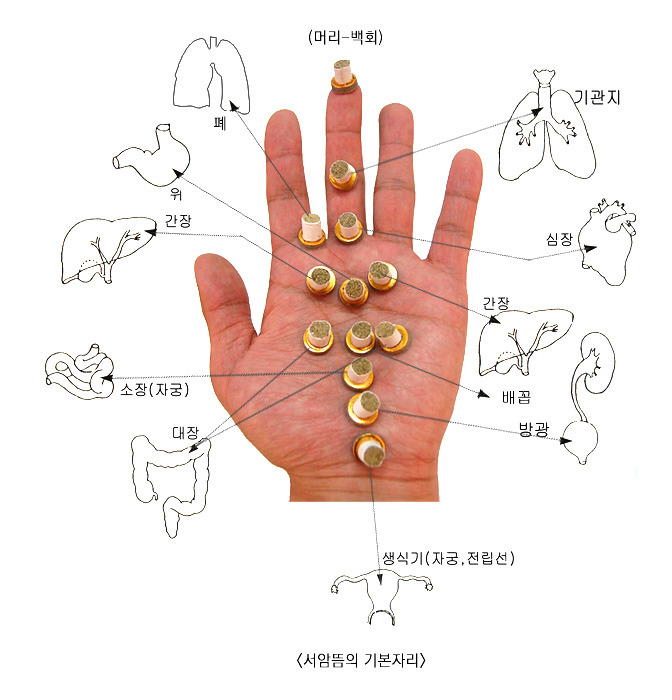뜸 이미지