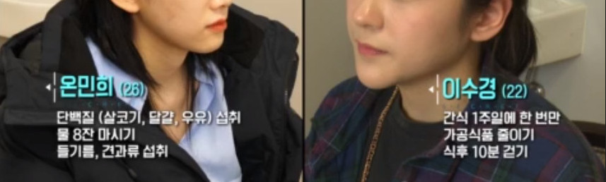 하루 17시간을 자는 22살 여자 대학생 | 인스티즈