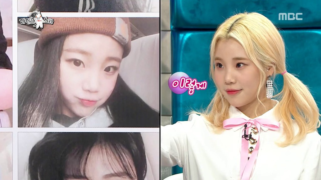 [라디오스타] 코수술 사실을 소속사에 숨겼다가 딱 걸린 주이.jpgif | 인스티즈