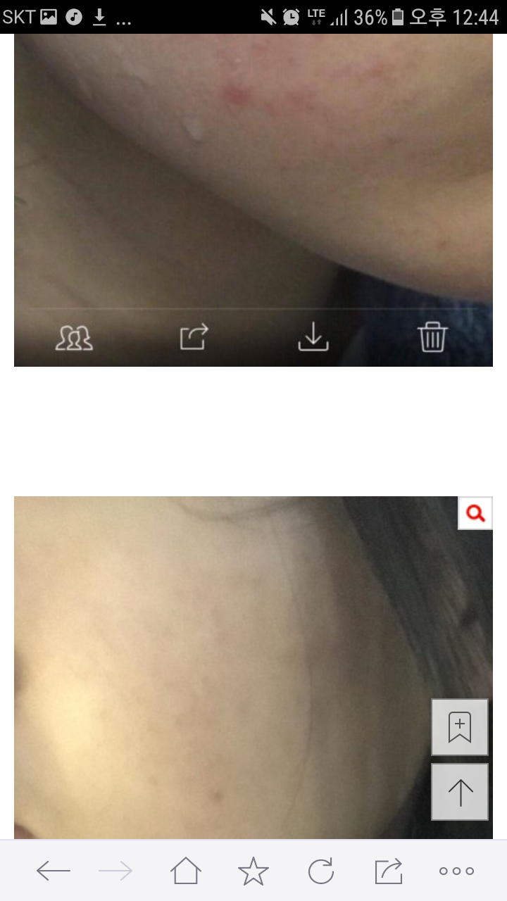 피부 안좋은사람들 진짜 90％ 좋아지는법 알려줄게 | 인스티즈