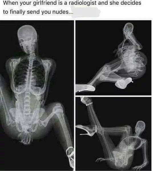 간호사 여친이 병원에서 찍어서 보낸 누드 사진이다.jpg | 인스티즈